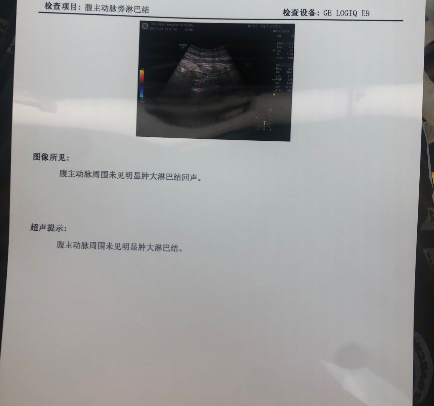 拜托帮忙看下淋巴结彩超很害怕