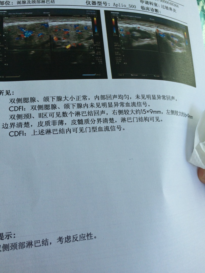 低烧半年下颌淋巴结肿大求助