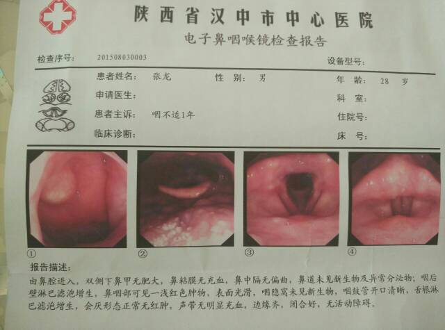 鼻咽肿物-淋巴瘤之家