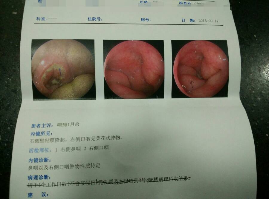 报告上写妈妈患弥漫大b细胞淋巴瘤可能性大,请大家帮忙看下报告,已经