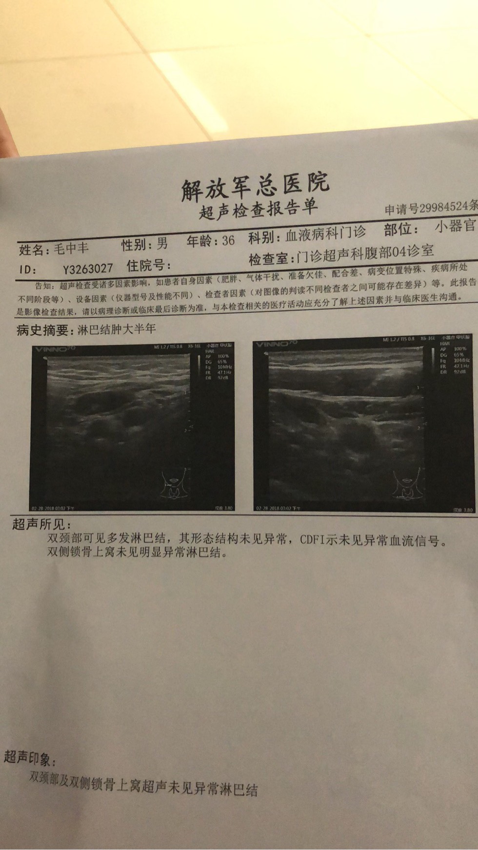 淋巴结节肿大