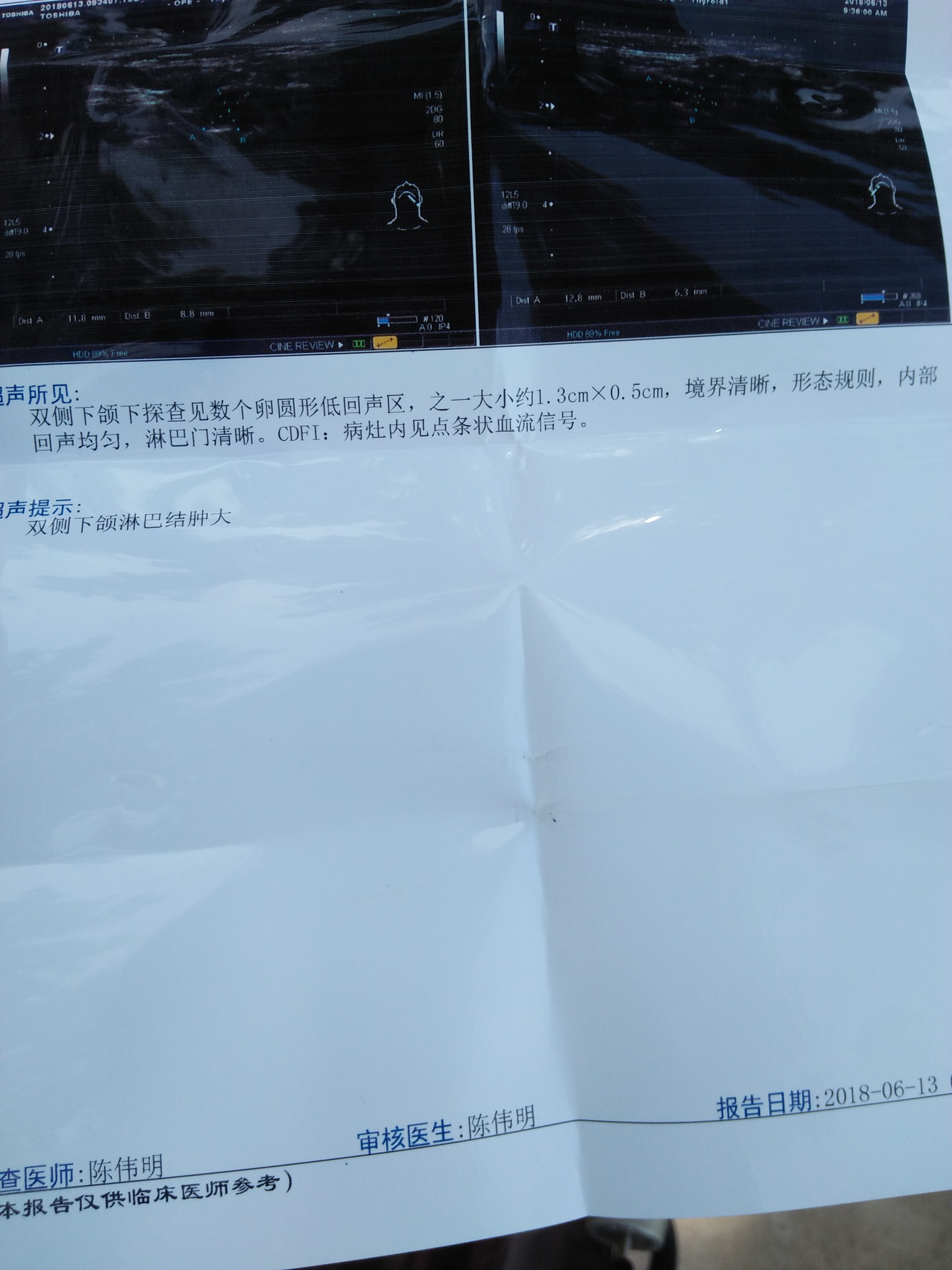 有多少是颌下淋巴结肿大的?