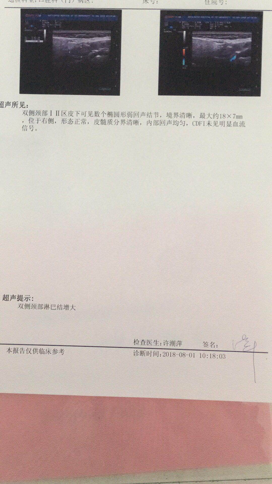 颈部,腋下淋巴结肿大,脸麻发胀,低头有牵拉感。