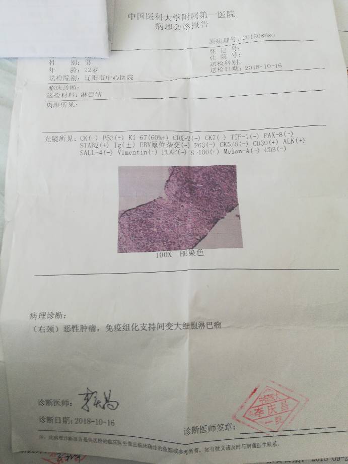 帮忙看看病理报告,求问还需要会诊吗?-淋巴瘤之家