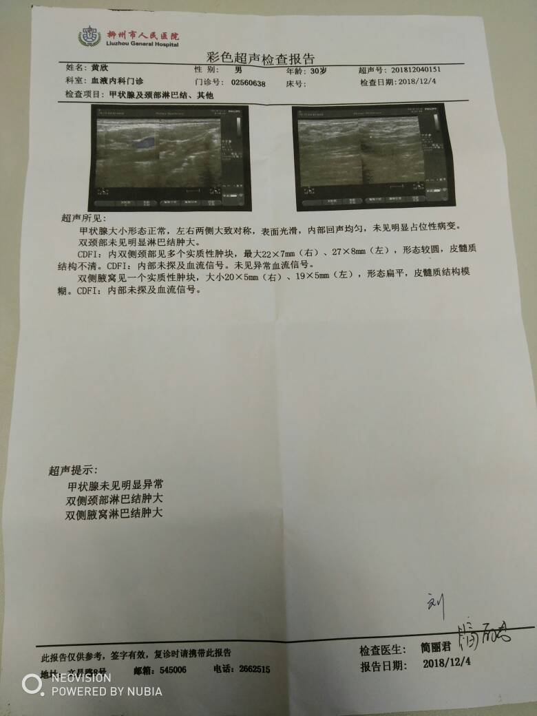 颈部,腋窝,腹股沟淋巴结肿大