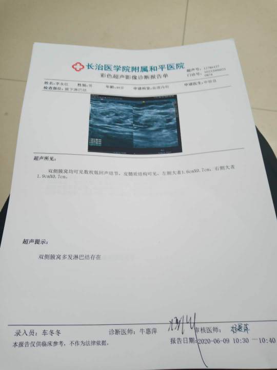 复查发现腋下及腹股沟多发淋巴结是复发了吗