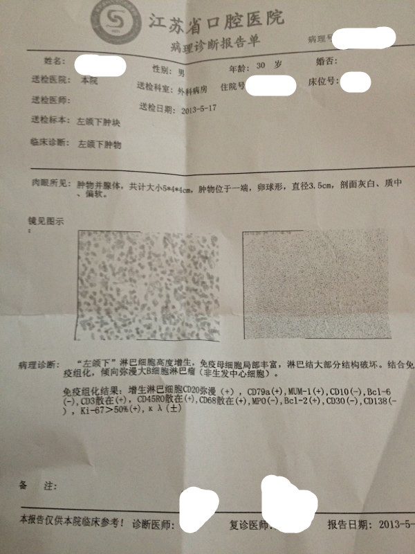 今天去了,说是没有医保的话,一个疗程chop化疗不用美罗华也要大几千