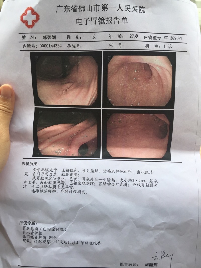胃癌中期胃镜单子图片图片