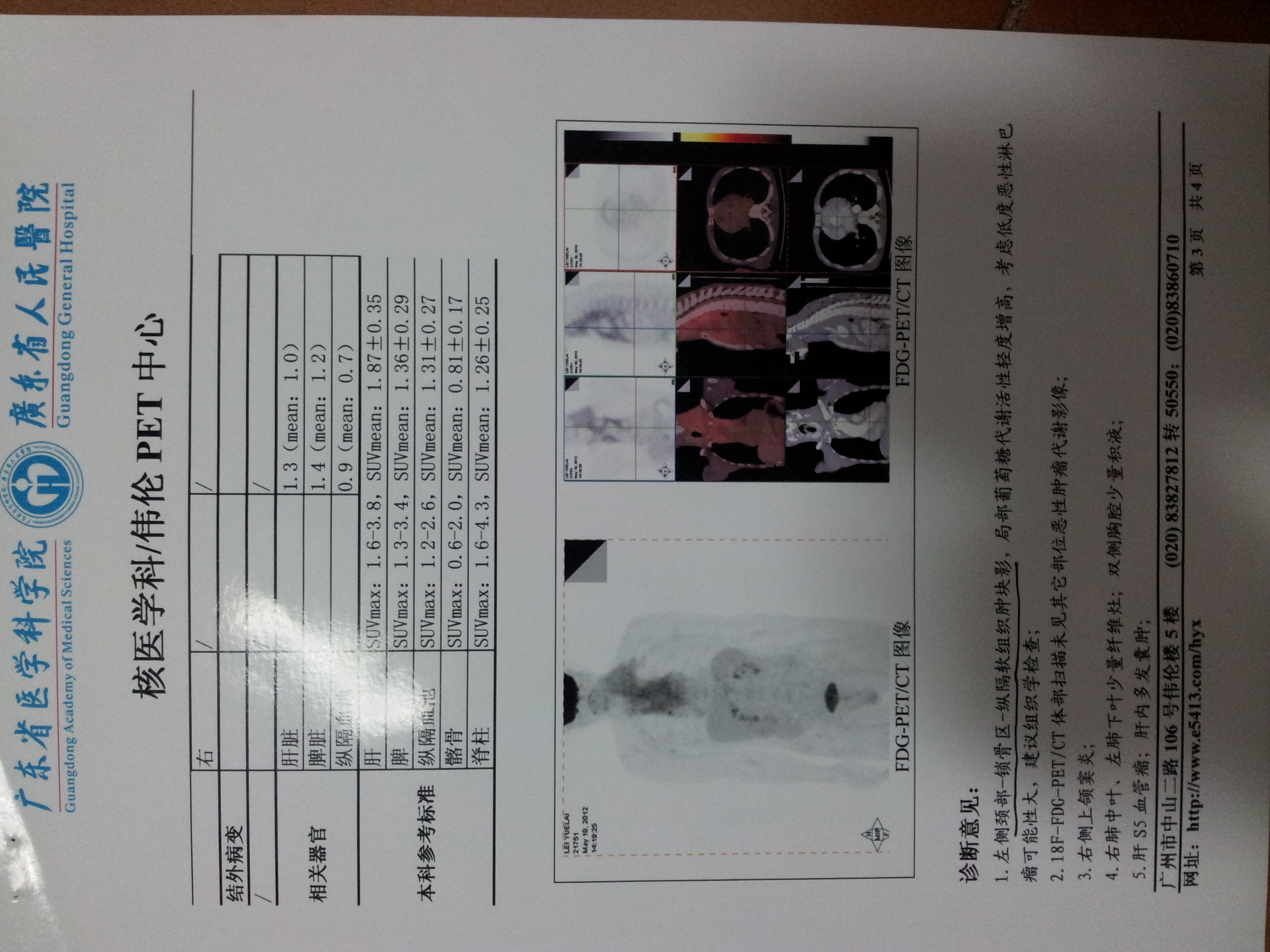 20120612_202918.jpg