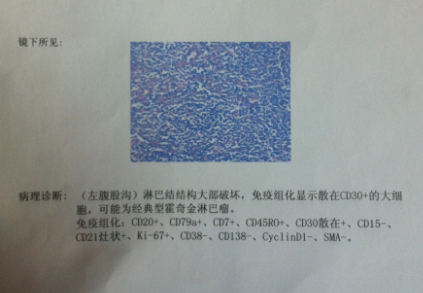 山肿.PNG