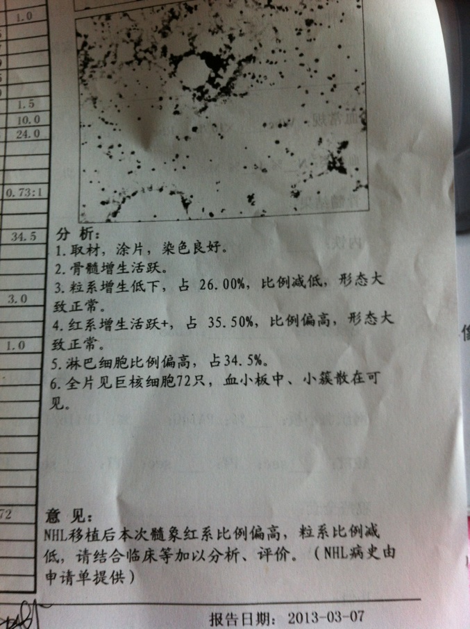 骨穿