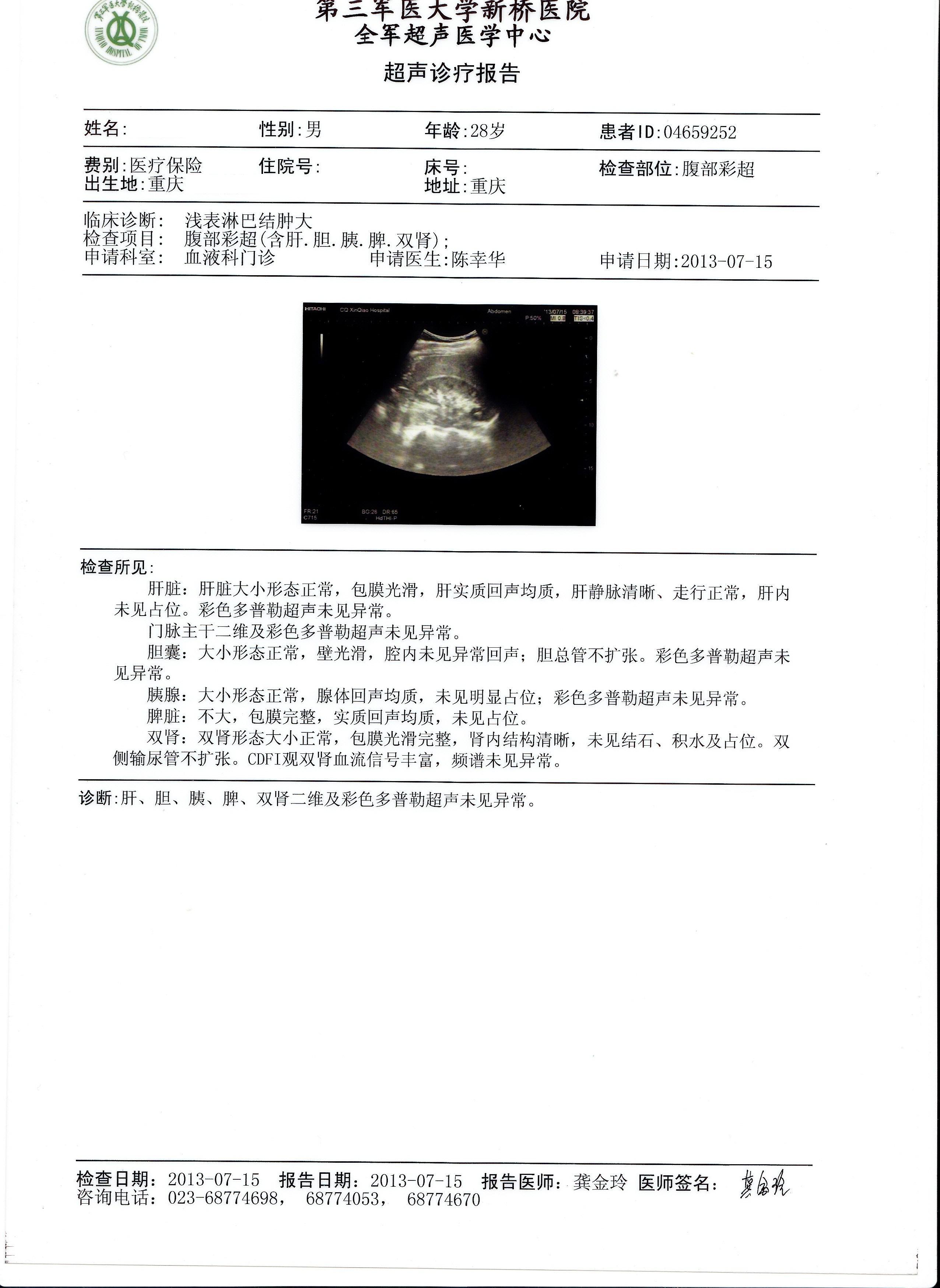 2013年7月15日肝胆胰脾肾彩超.jpg