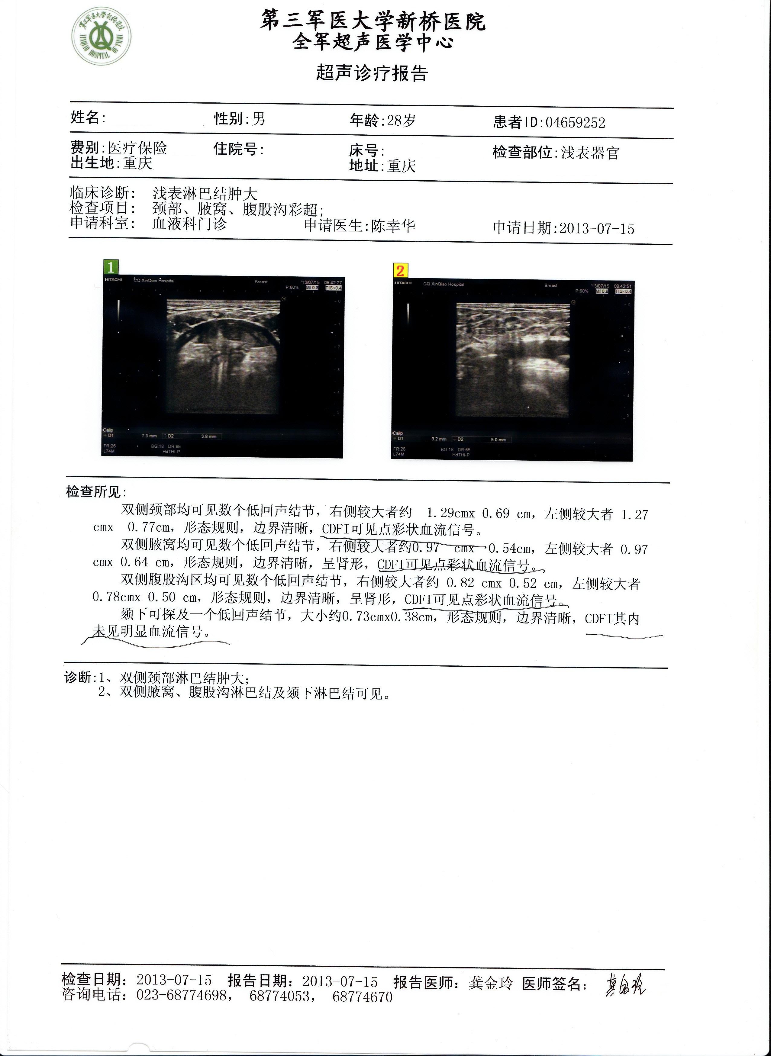 2013年7月15日颈部腋下腹股沟彩超.jpg