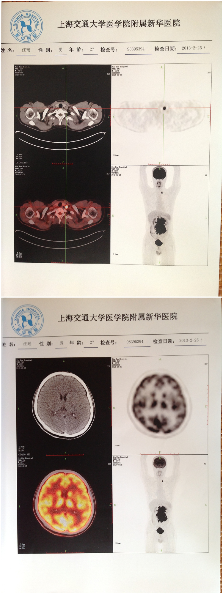 第一次3