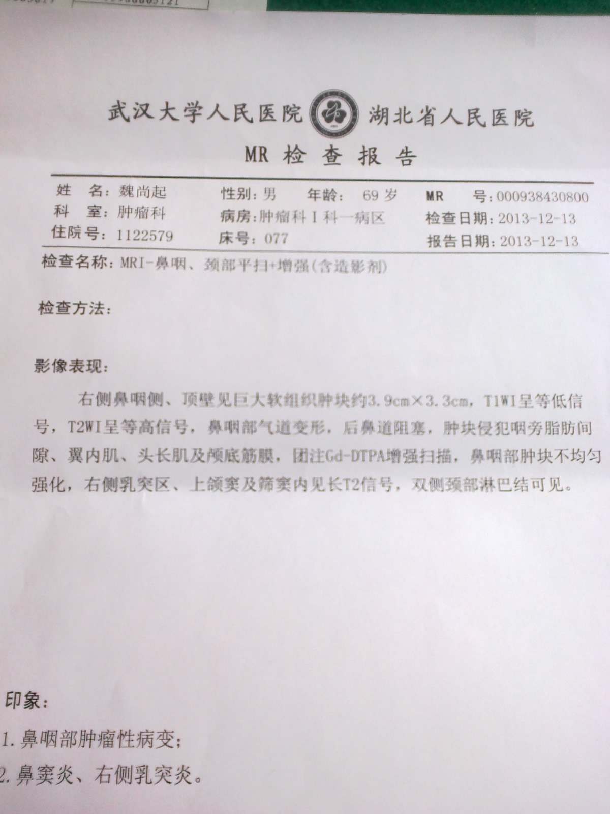 鼻咽mri
