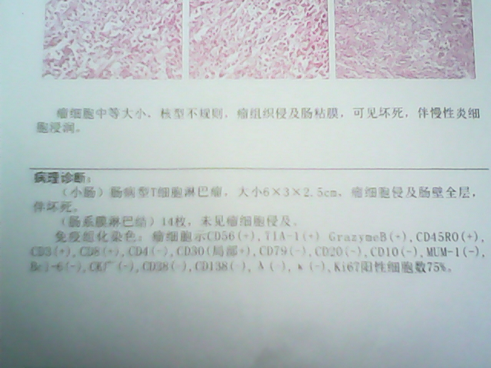 活检报告