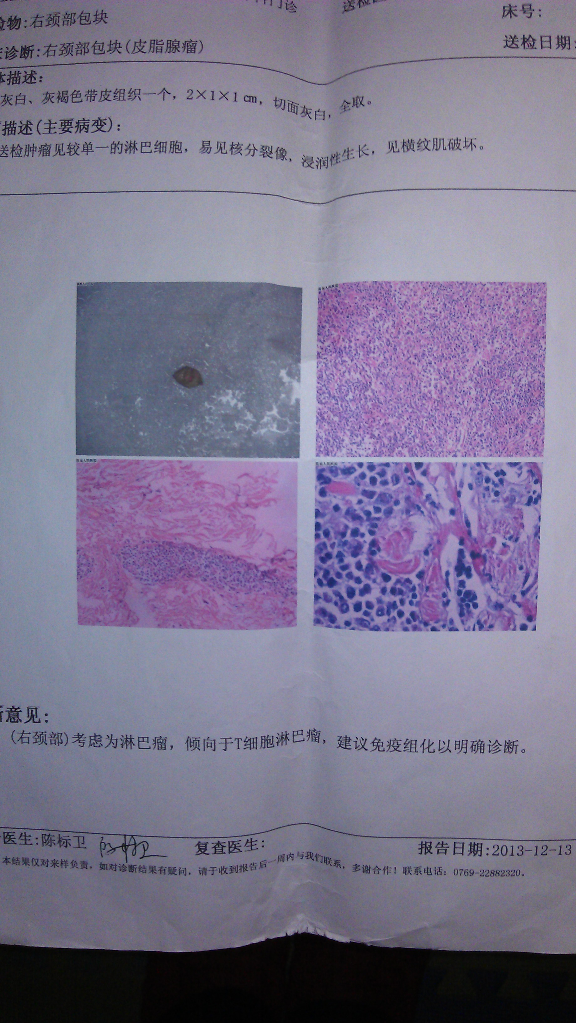 区医院外科术后病理