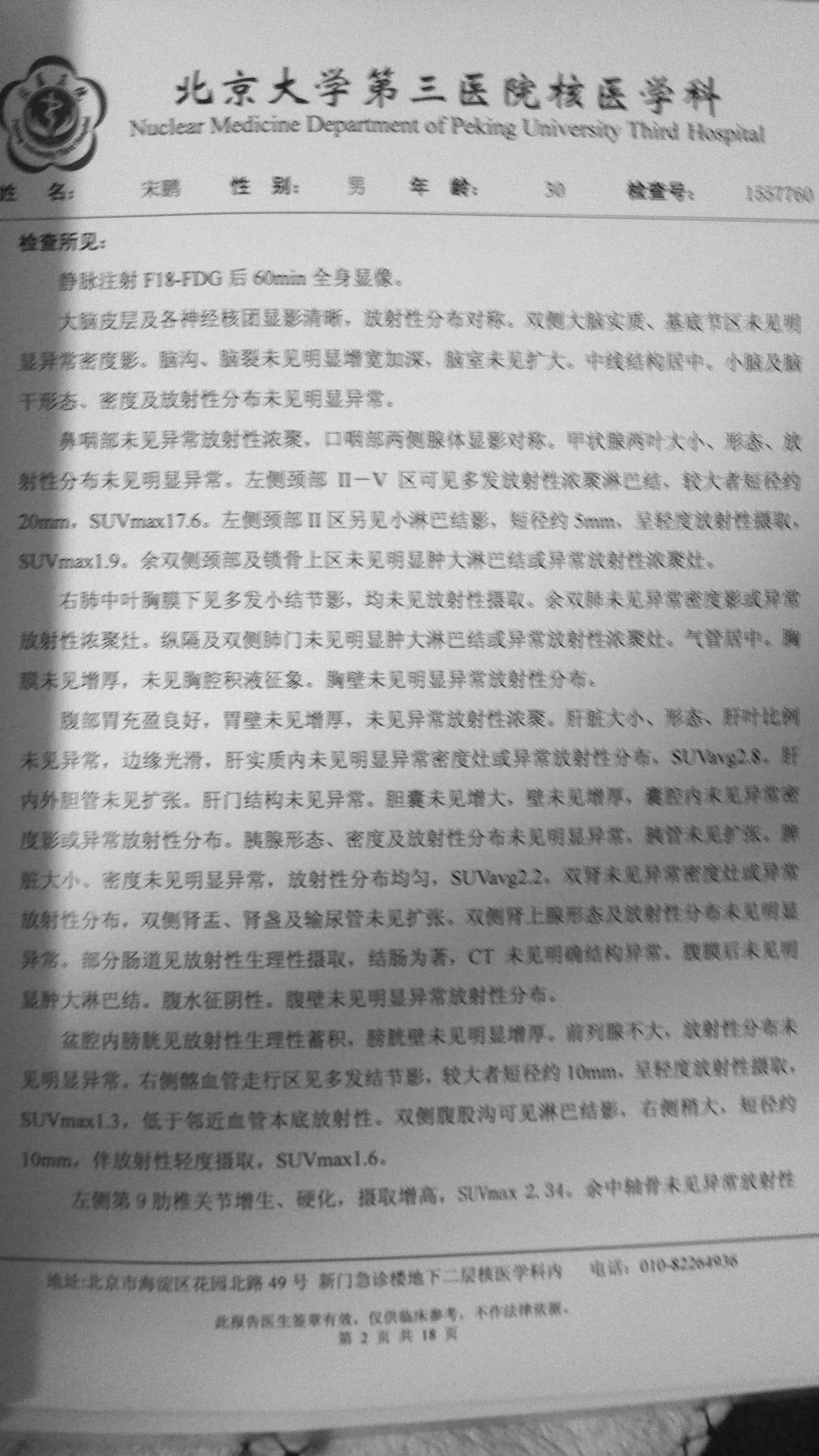 第一次PETCT