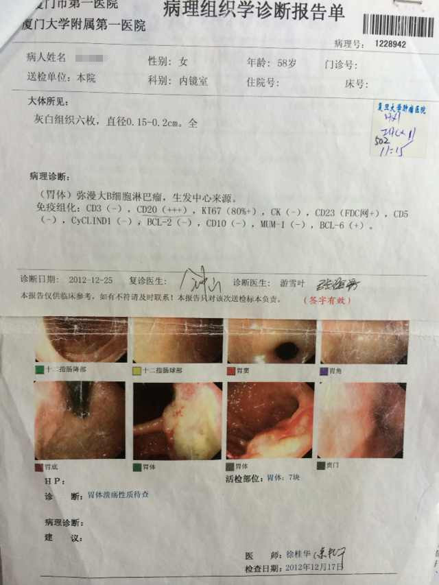 化疗前胃镜.jpg
