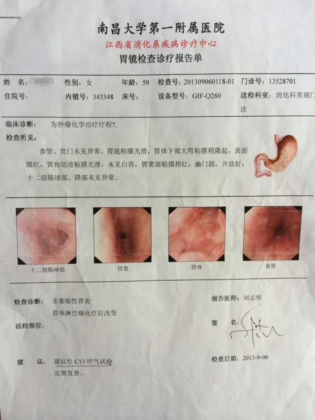 化疗后胃镜.jpg