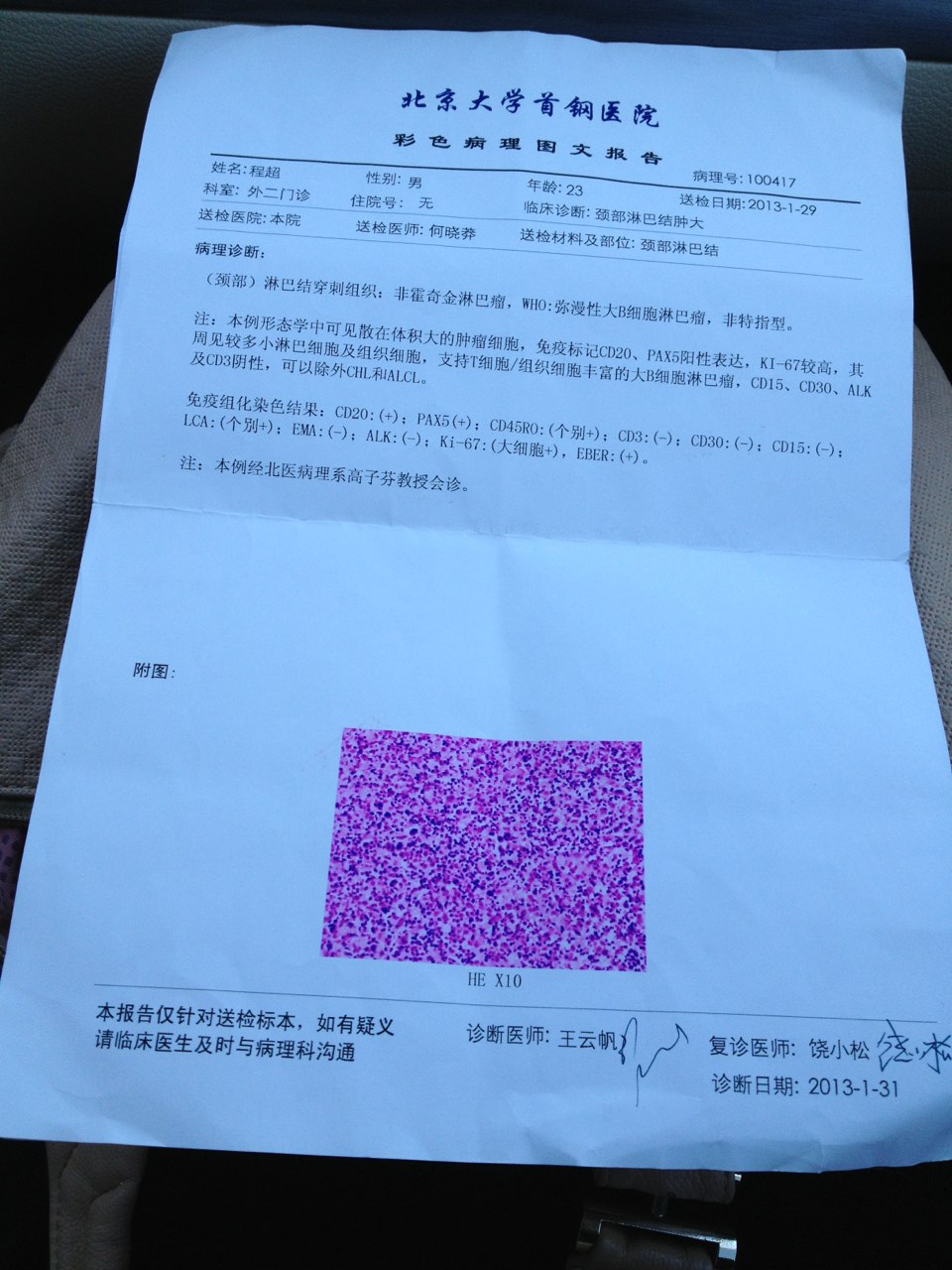 1.首钢医院病理结果