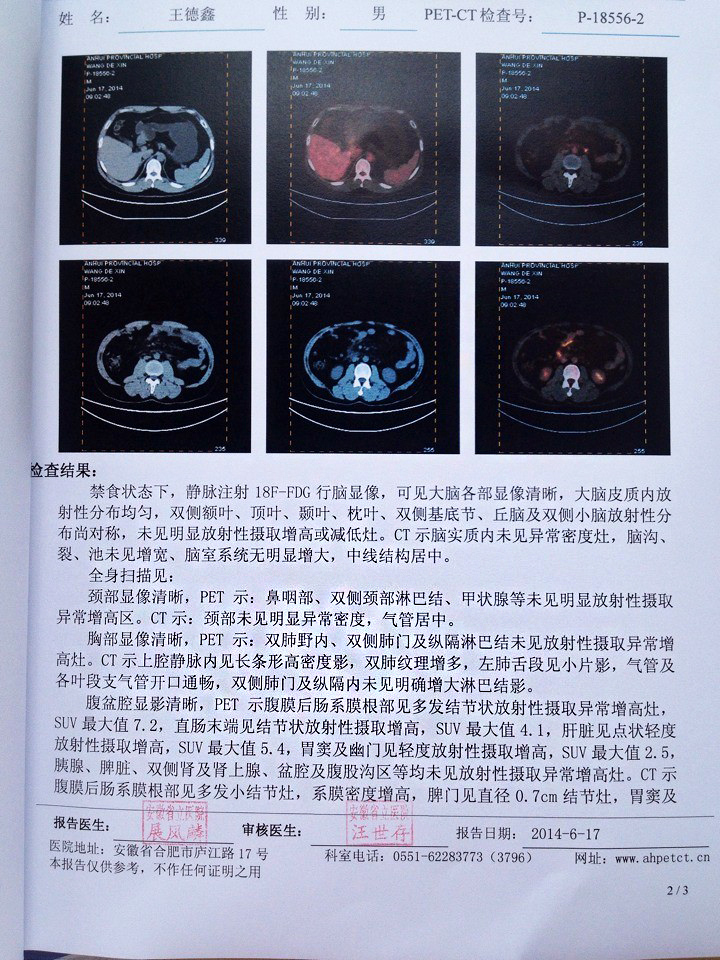 治疗后1