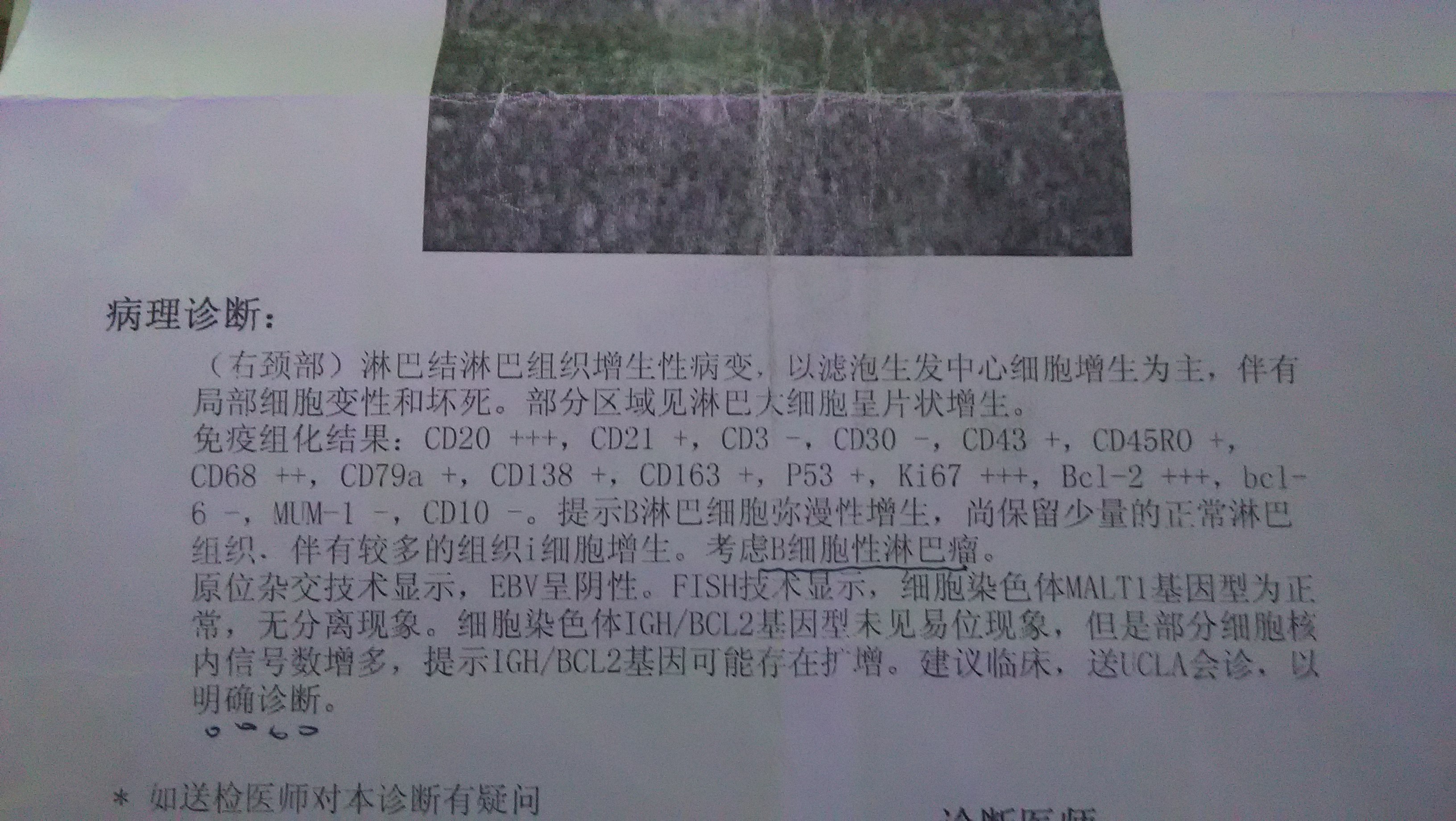 浙二医院给的病理报告