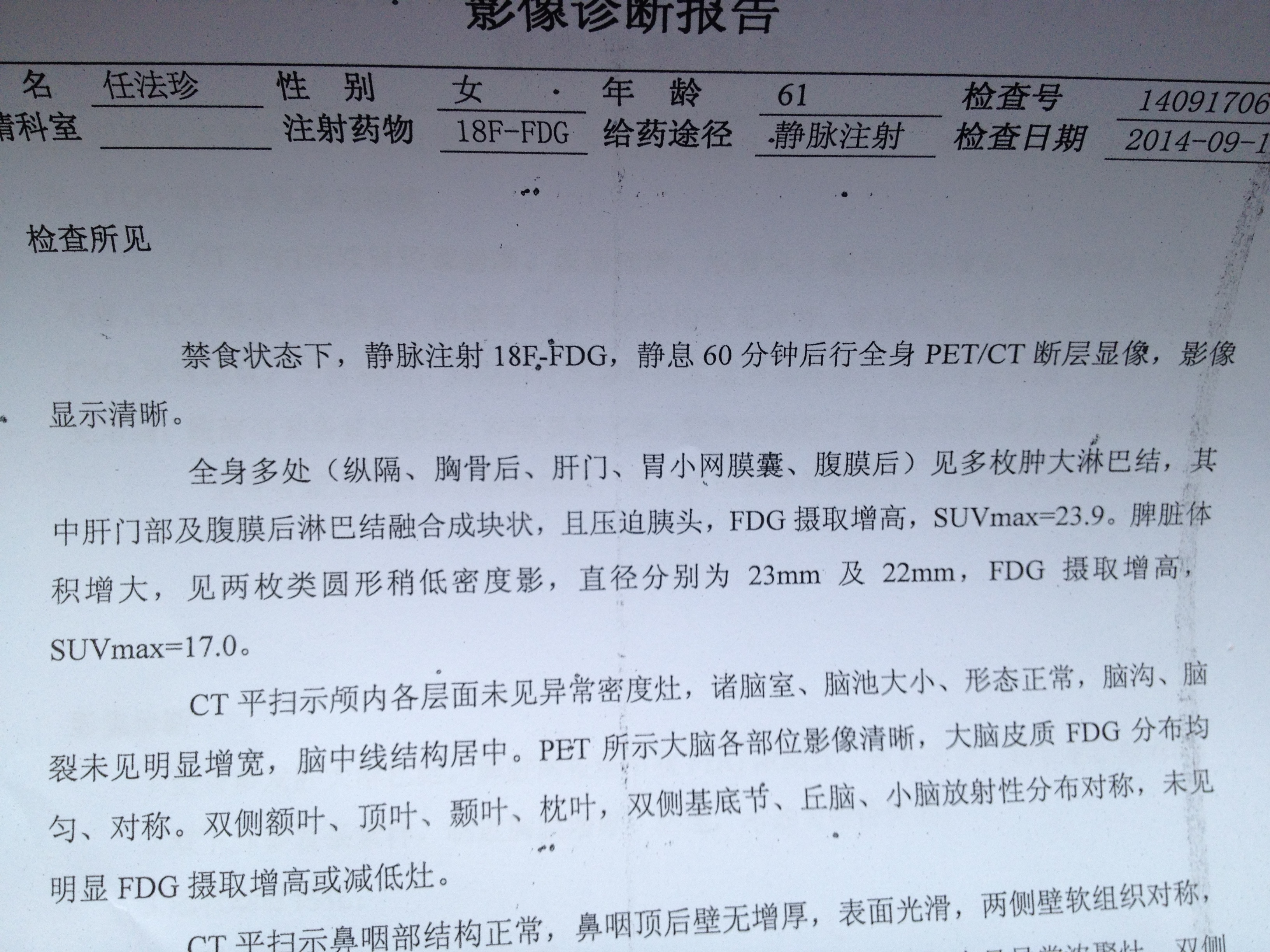 PET报告