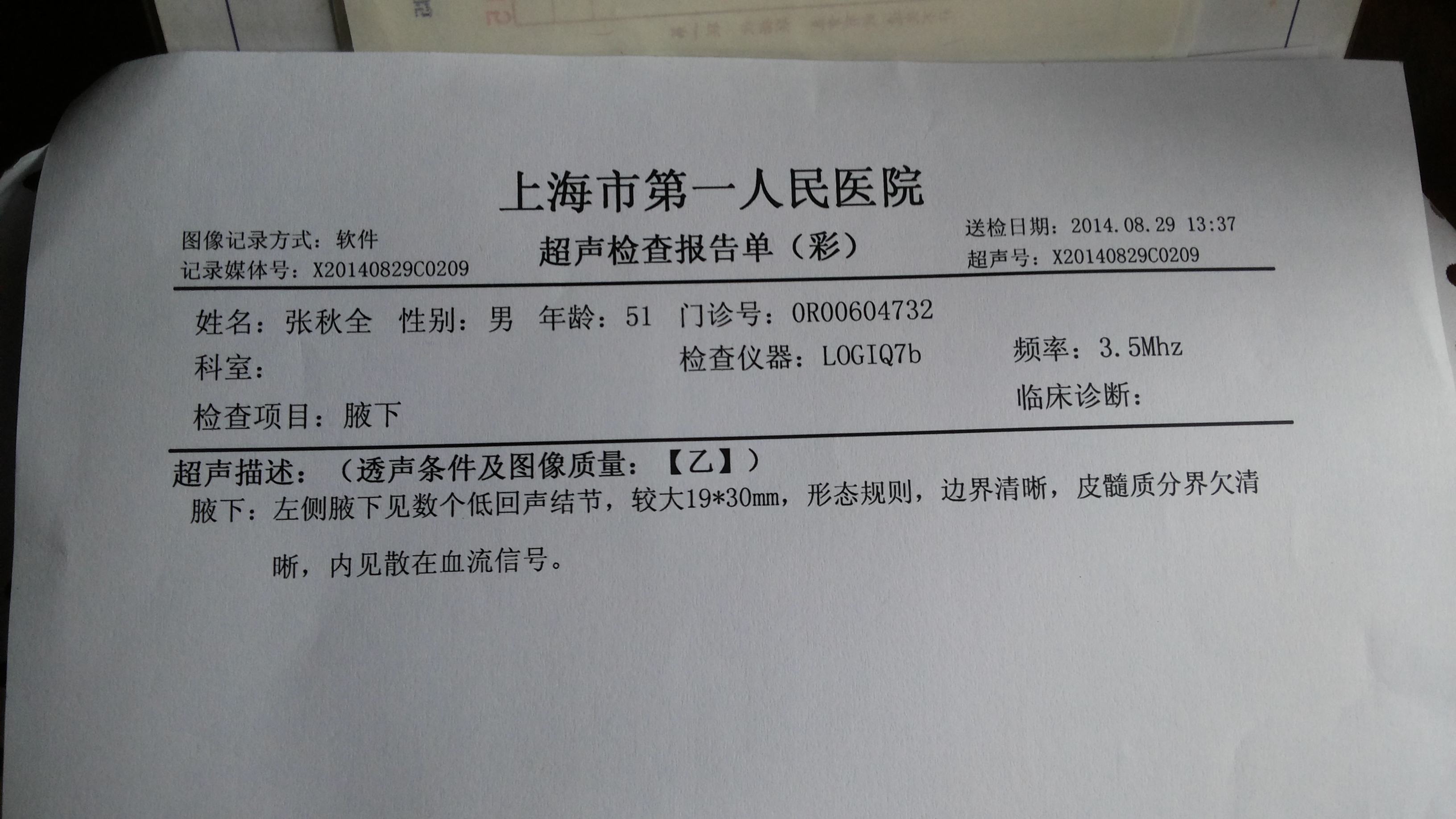 20140829_152757.jpg