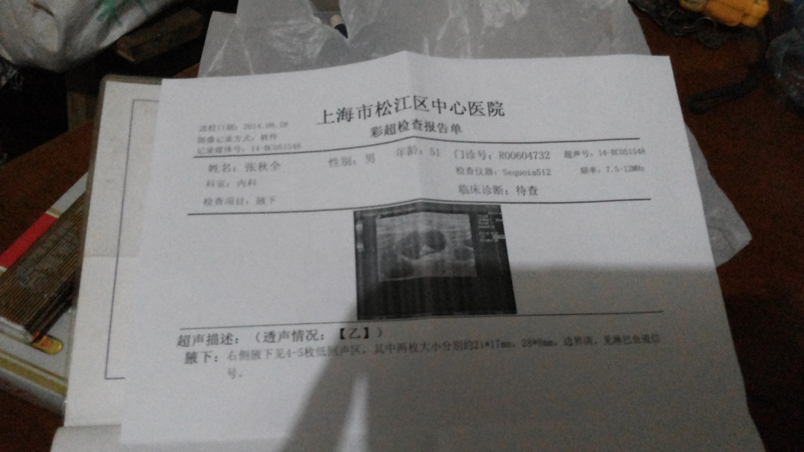 20140828_203943.jpg
