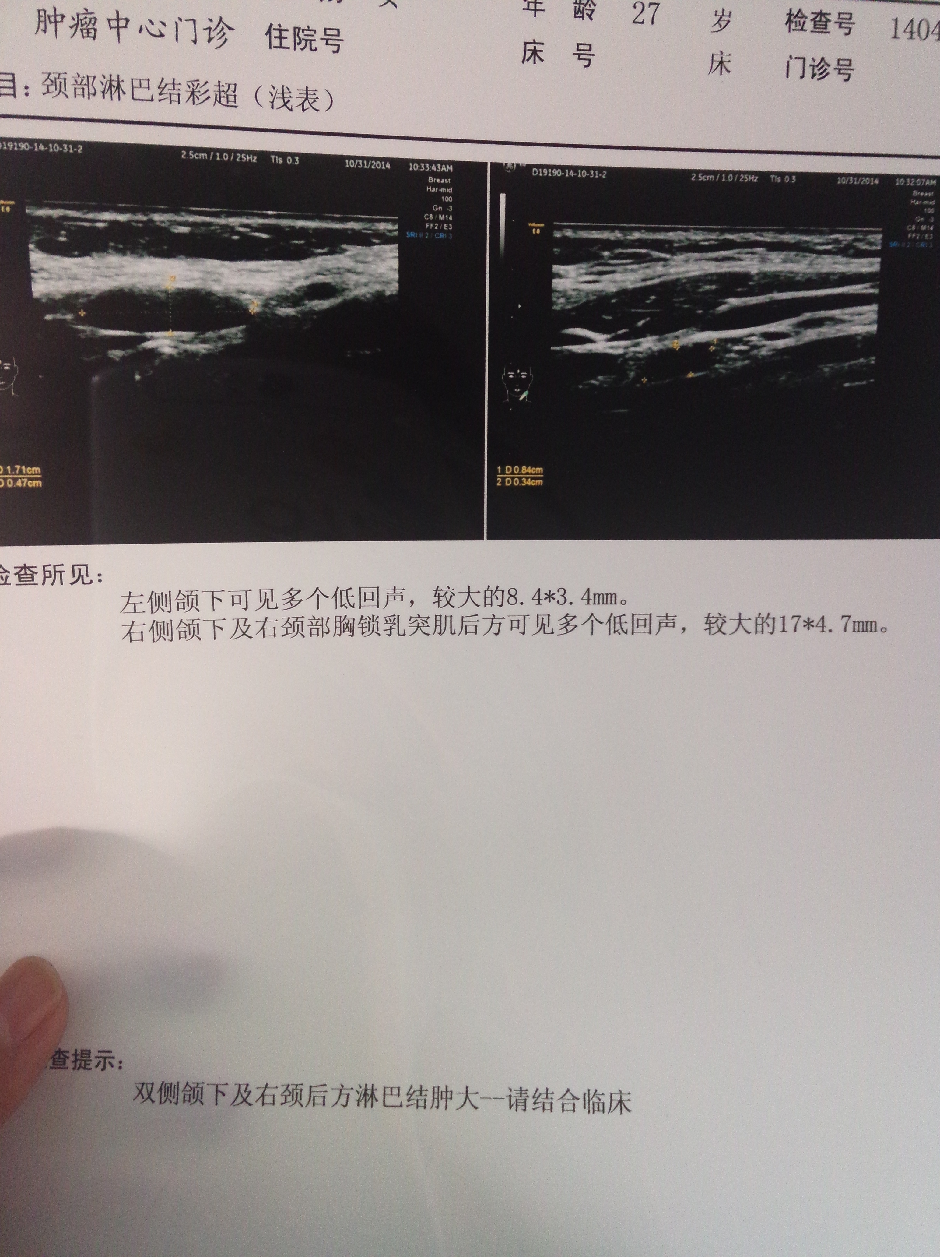 IMG20141031113424.jpg
