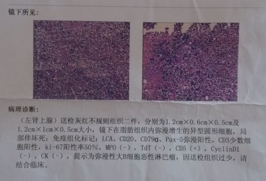 活检报告.jpg