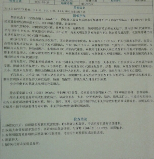 144756o3no49ljswz9blnb.jpg