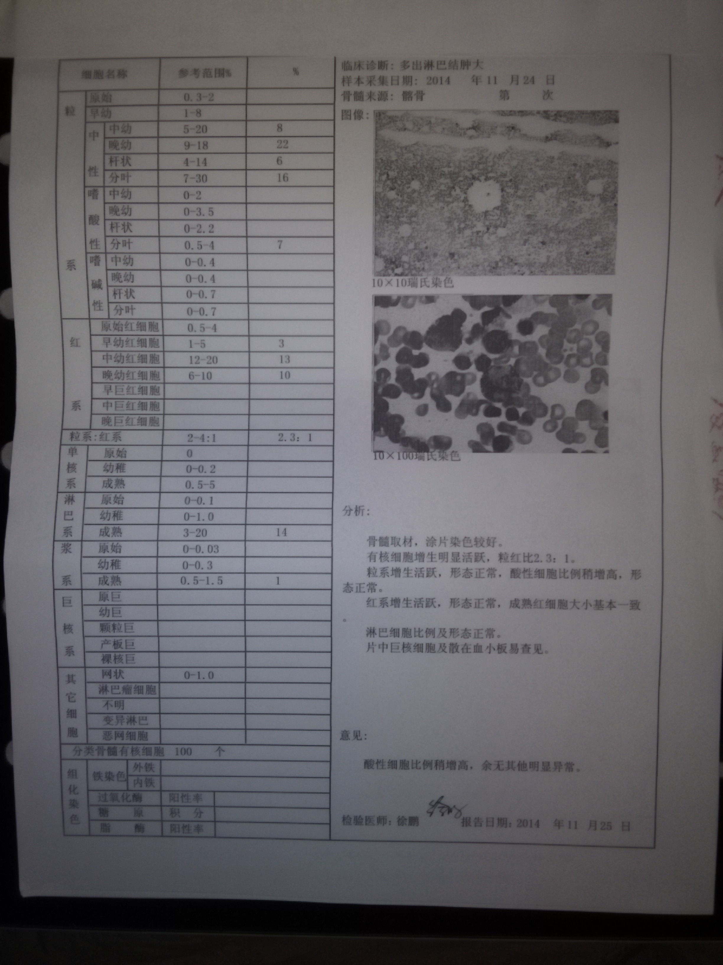 骨髓细胞形态学图像诊断分析