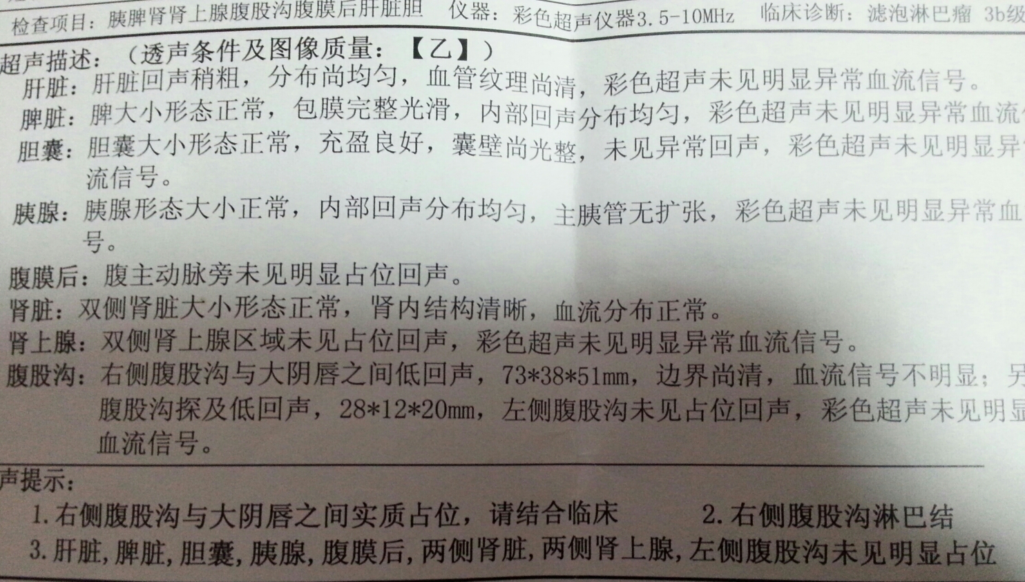 225853f2h27q8010un0if0.jpg