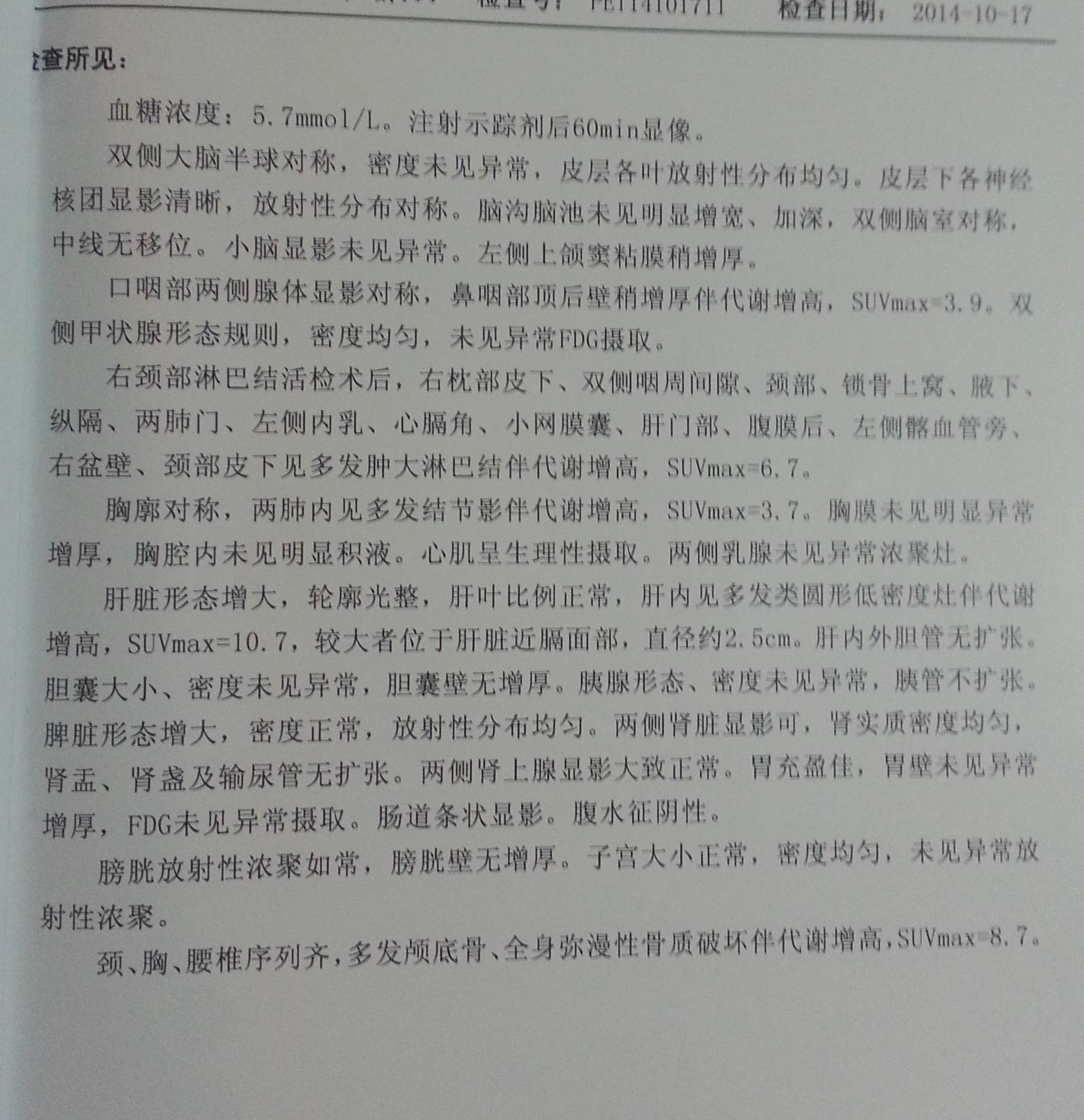 治疗前PET.jpg