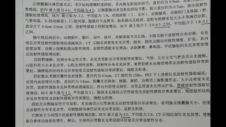 174705rwzkzdu7ek73j8xh.png