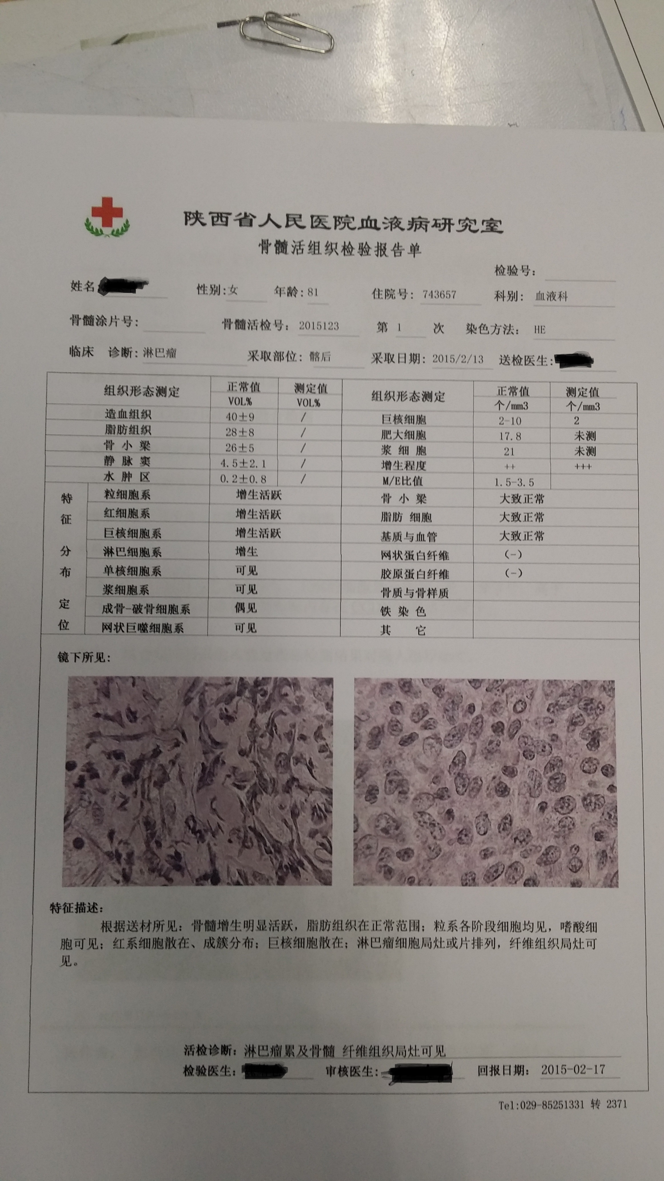 骨髓活检报告