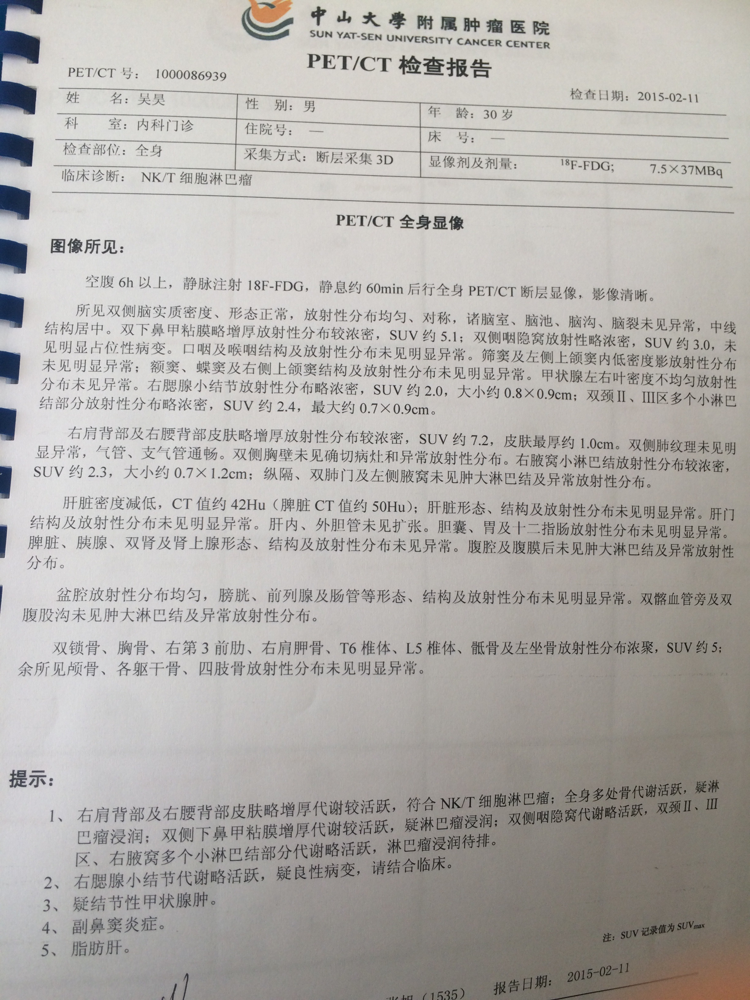 014325ppw0hppkananprhk.jpg