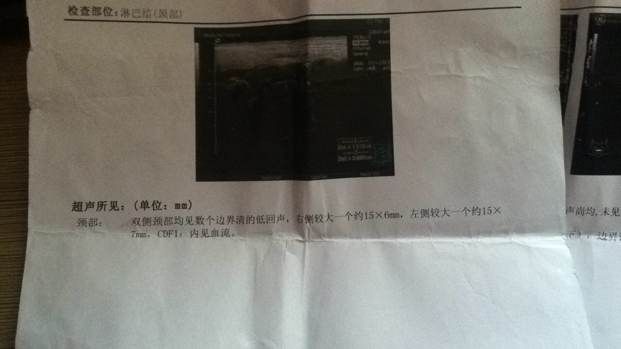 125005sku44sux4uskbc43.png