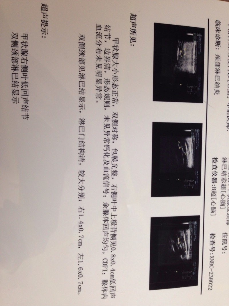 104843os0ftt661dhi1ghh.jpg
