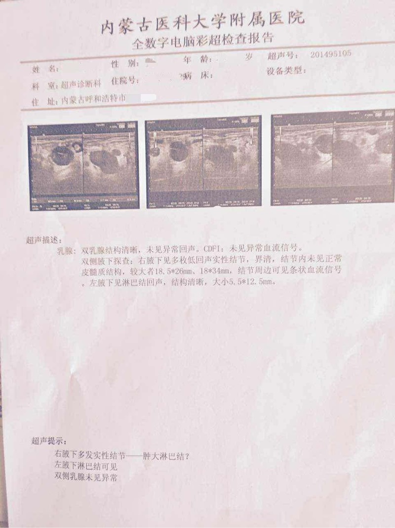 180438lyh4t5tee5tpdeav.jpg