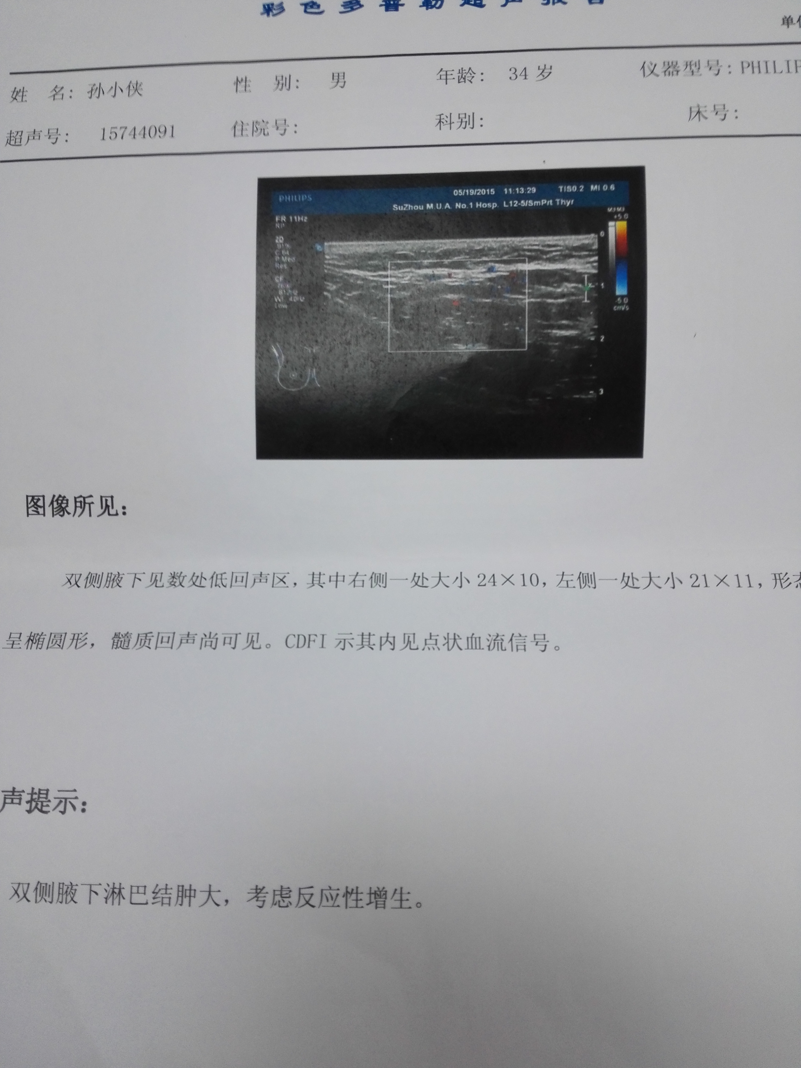 0519B超.jpg