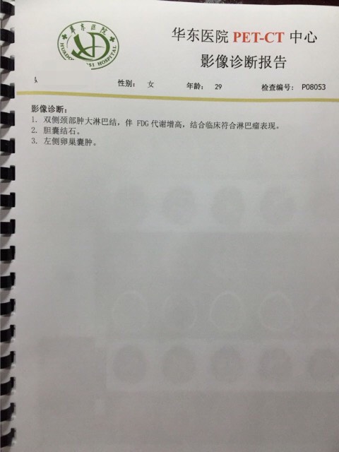 204101yxcjjnxii2ceiiia.jpg