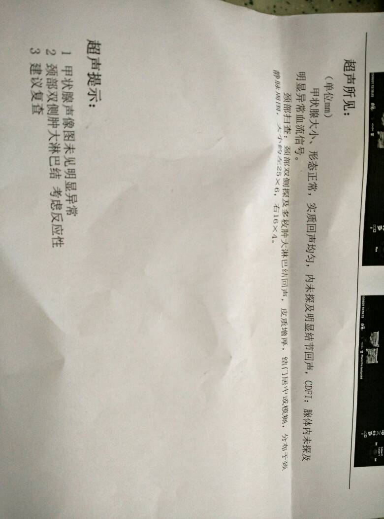 182110uwhdnz8b9jh8ajln.jpg