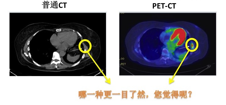 pet-ct.jpg