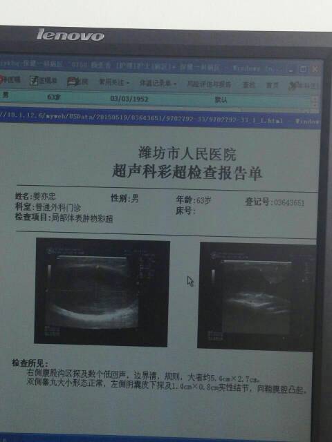 173954wxbxqxr04oxn4xso.jpg