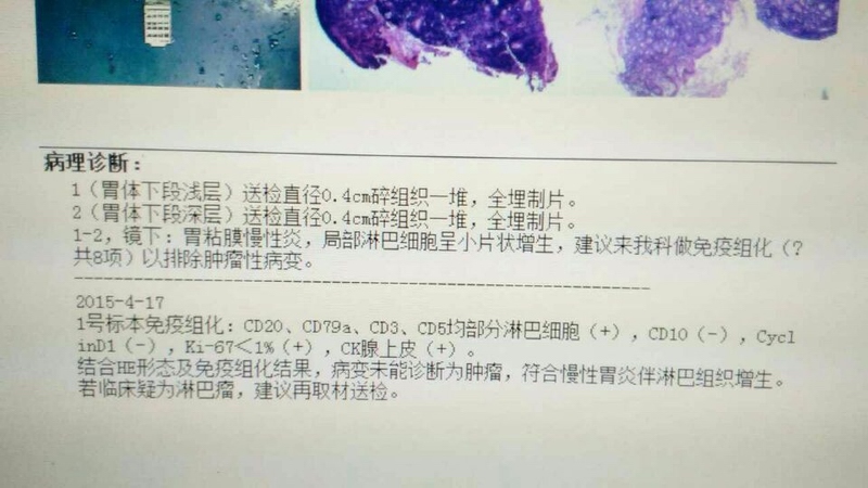 1504胃.jpg
