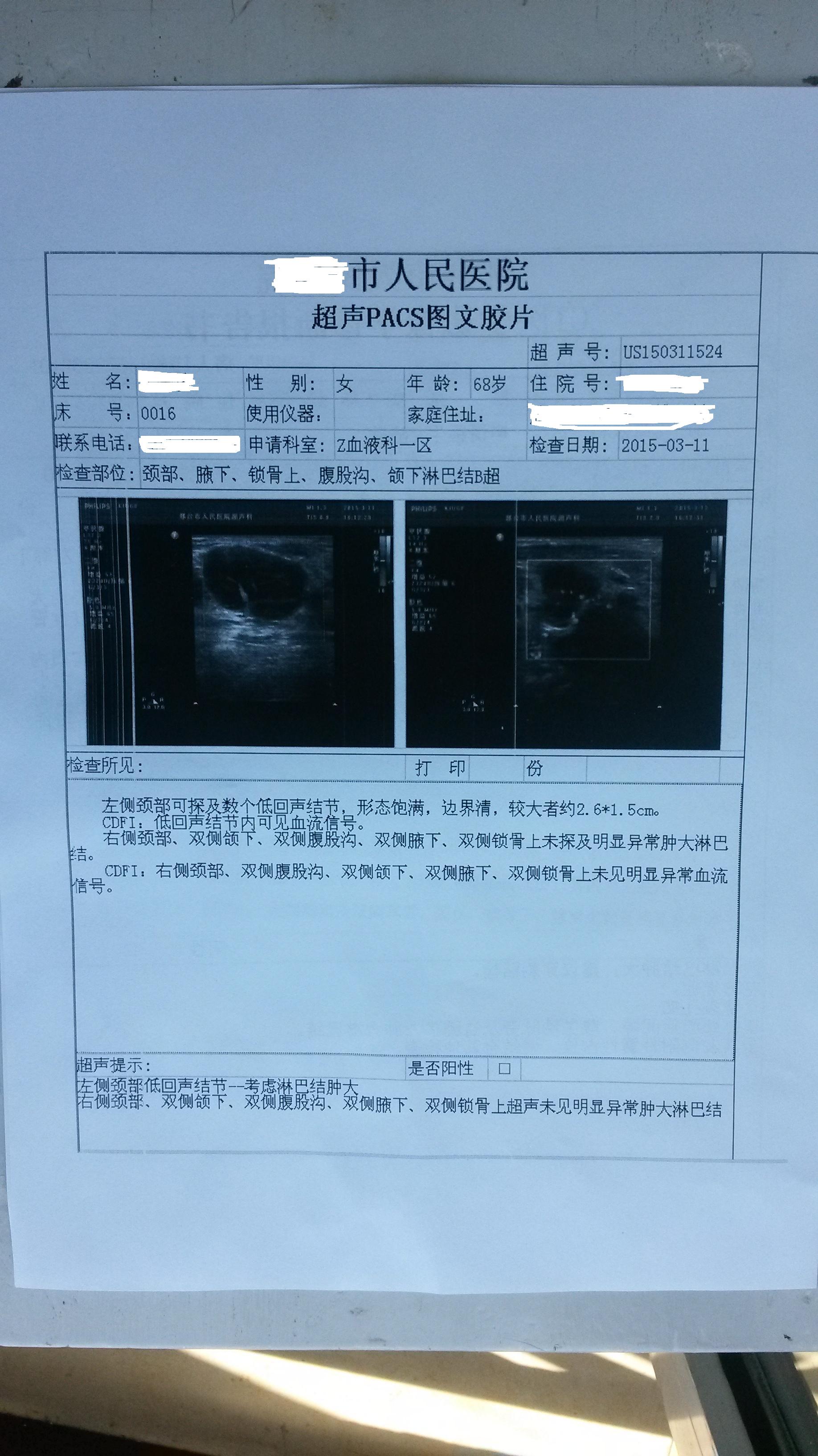 3月11日超声.JPG