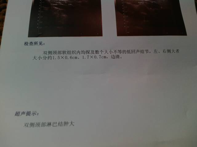 090246eou011wkda5midzq.jpg